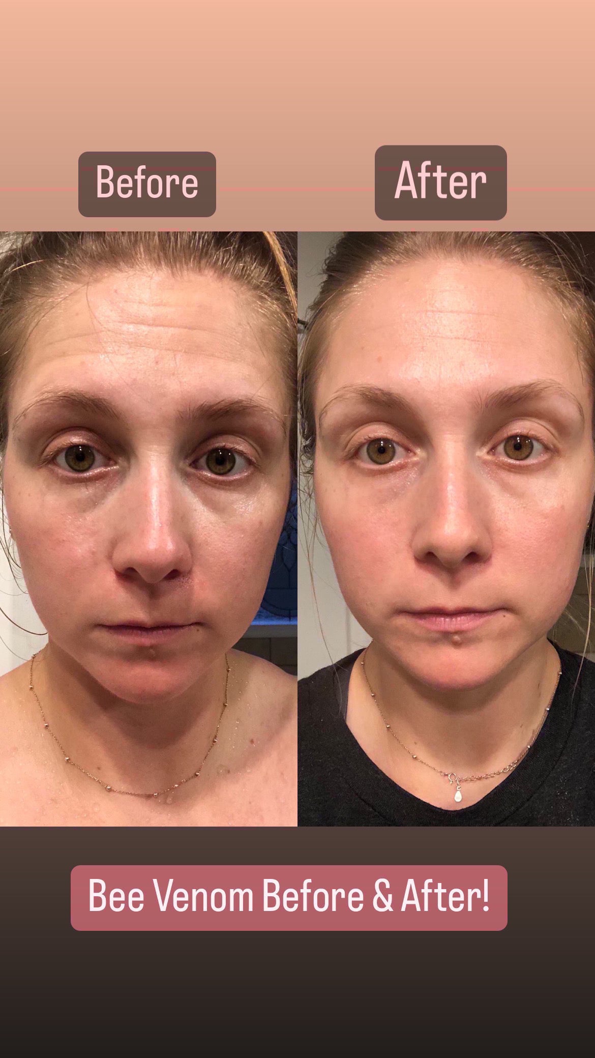 Better Than Botox Bee Venom Silk Serum