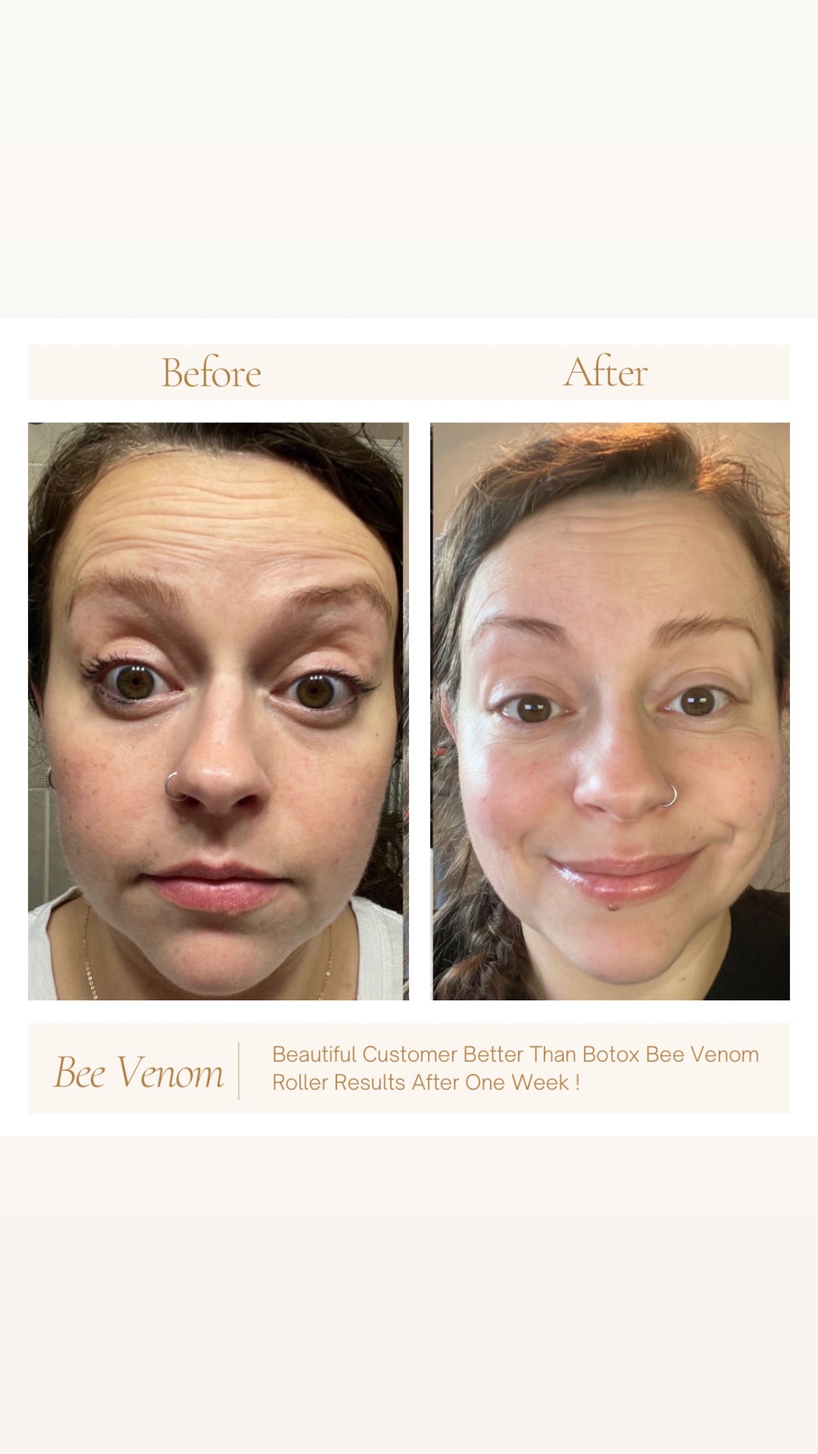Better Than Botox Collection