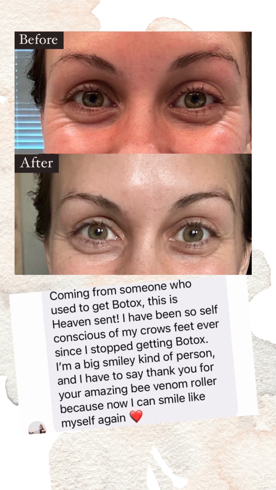 Better Than Botox Bee Venom Vanish Roller