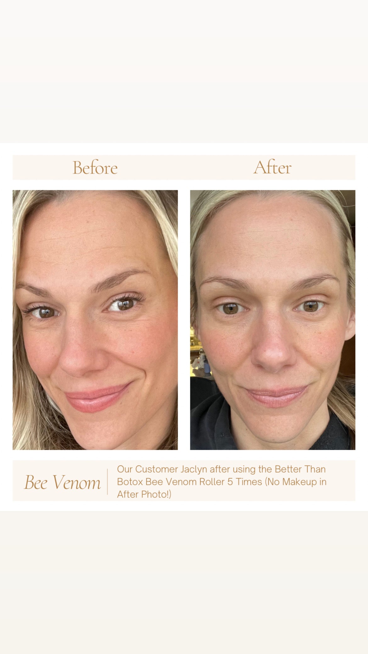 Better Than Botox Collection