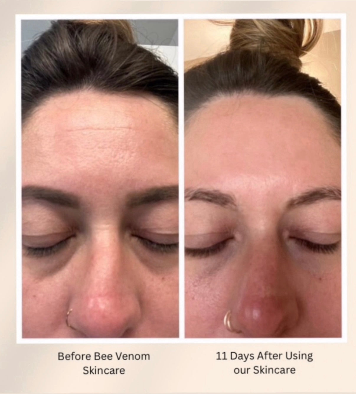 Better Than Botox Bee Venom Vanish Roller