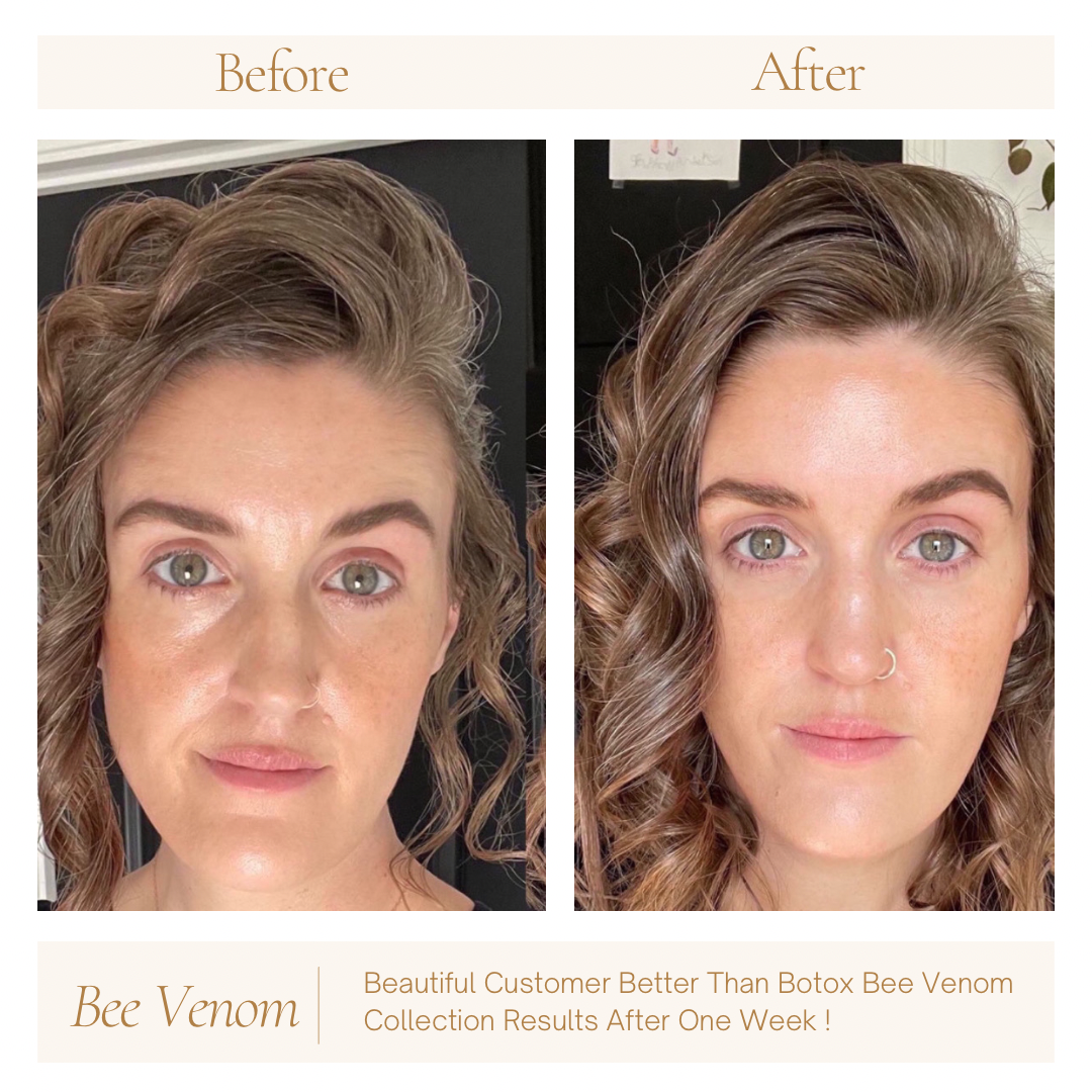 Better Than Botox Bee Venom Vanish Roller