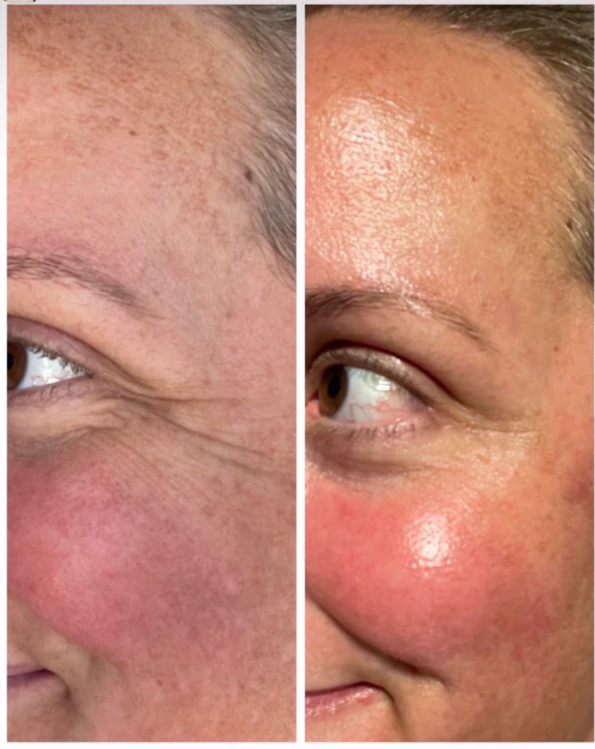 Bee Venom Tallow Balm