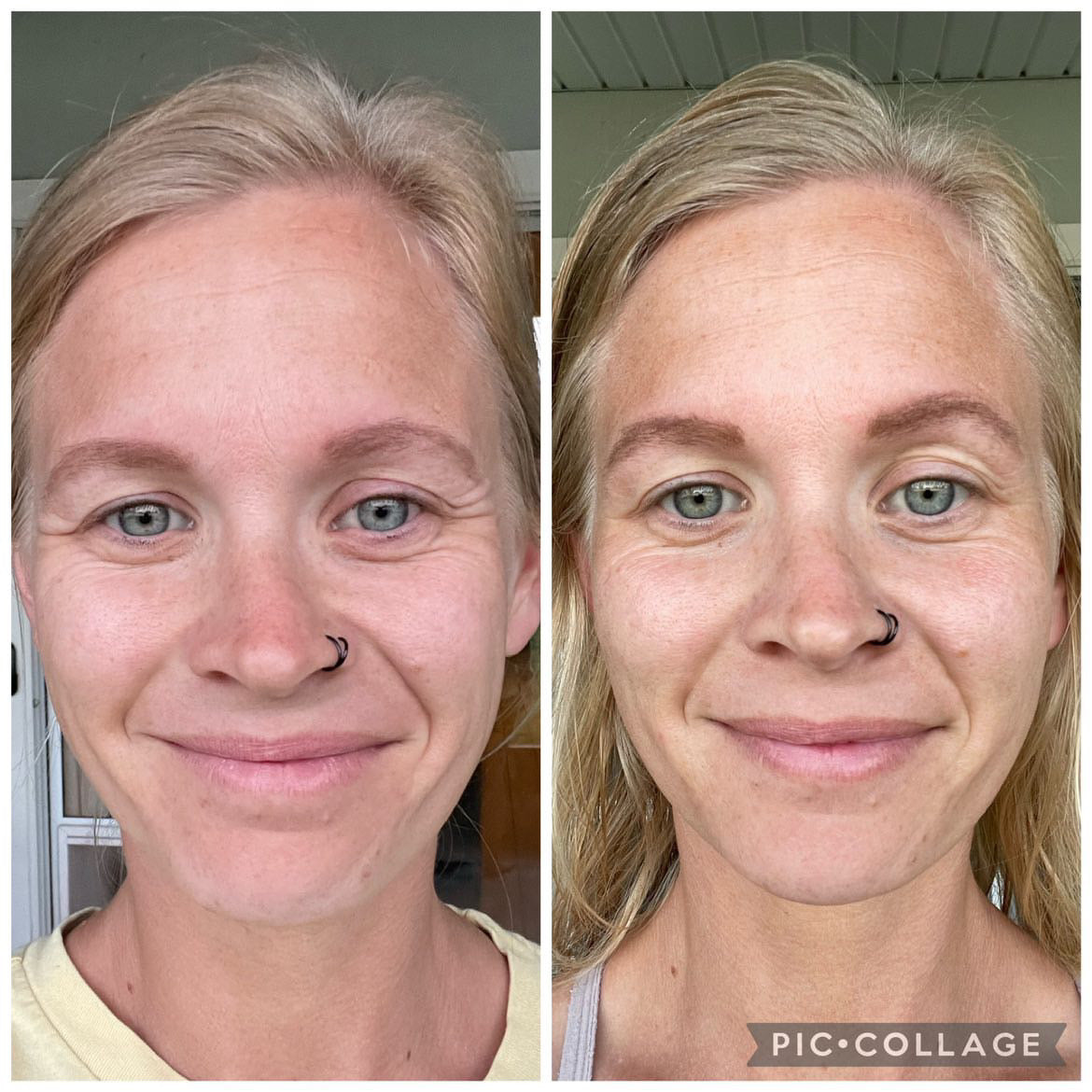 Better Than Botox Bee Venom Vanish Roller