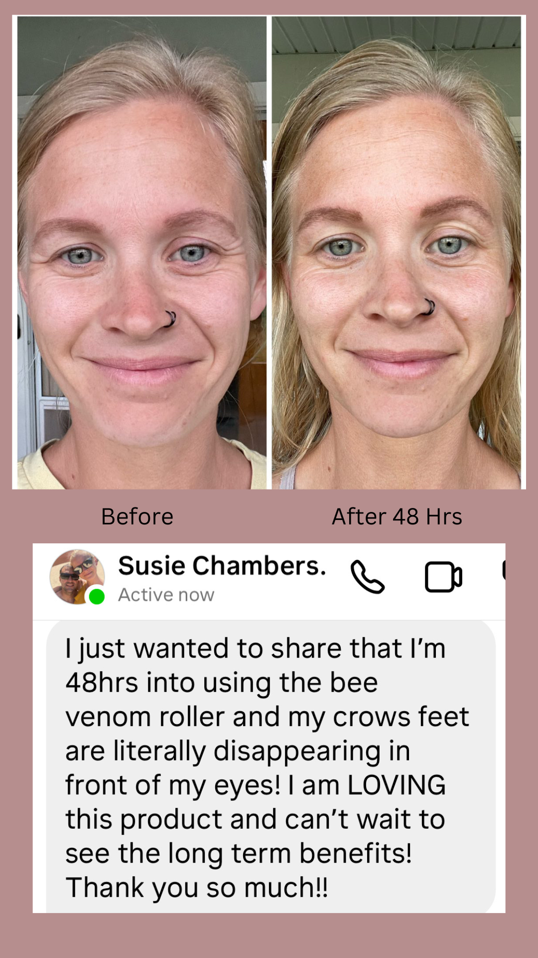 Better Than Botox Collection