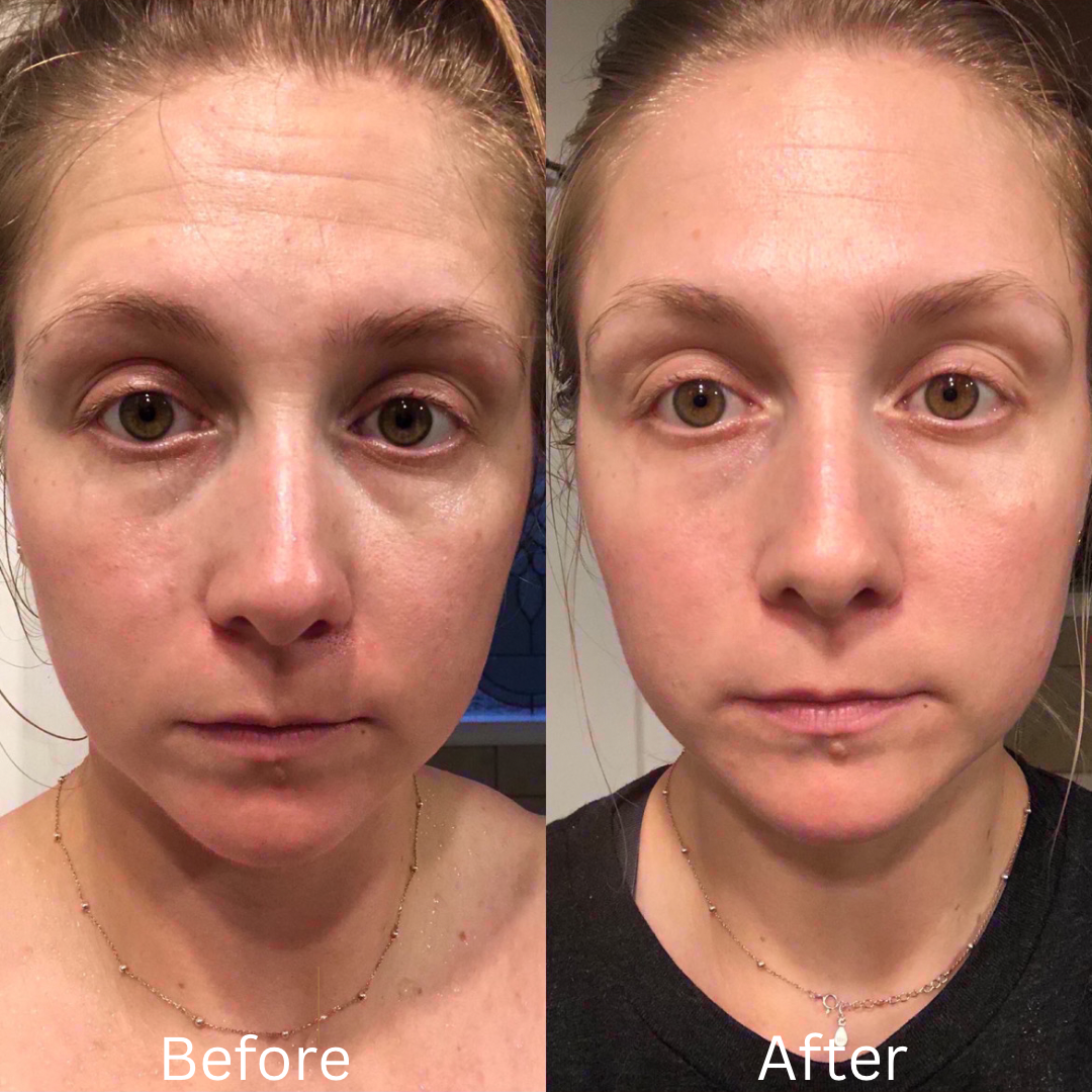 Better Than Botox Bee Venom Vanish Roller