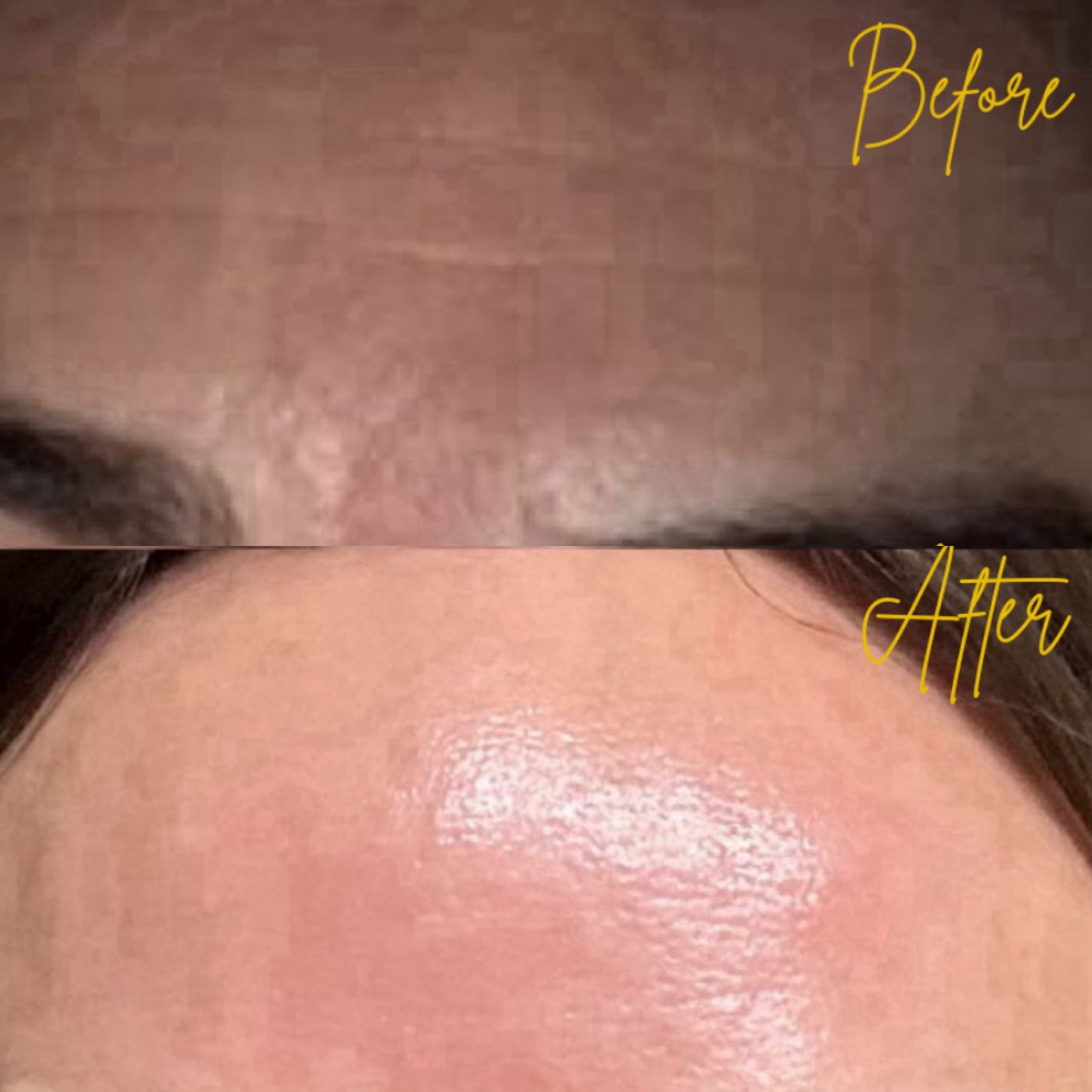 Better Than Botox Bee Venom Vanish Roller