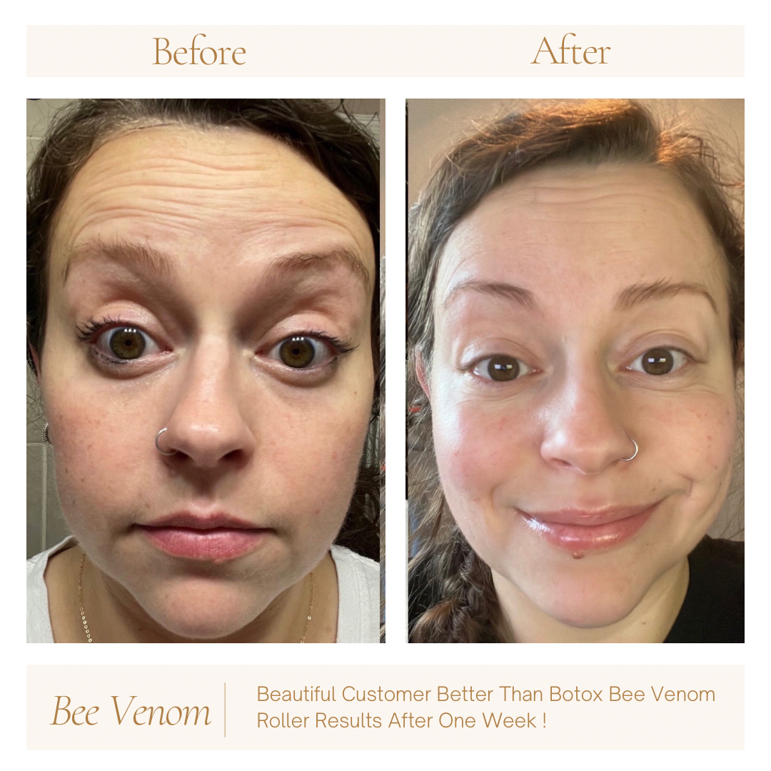 Better Than Botox Bee Venom Vanish Roller