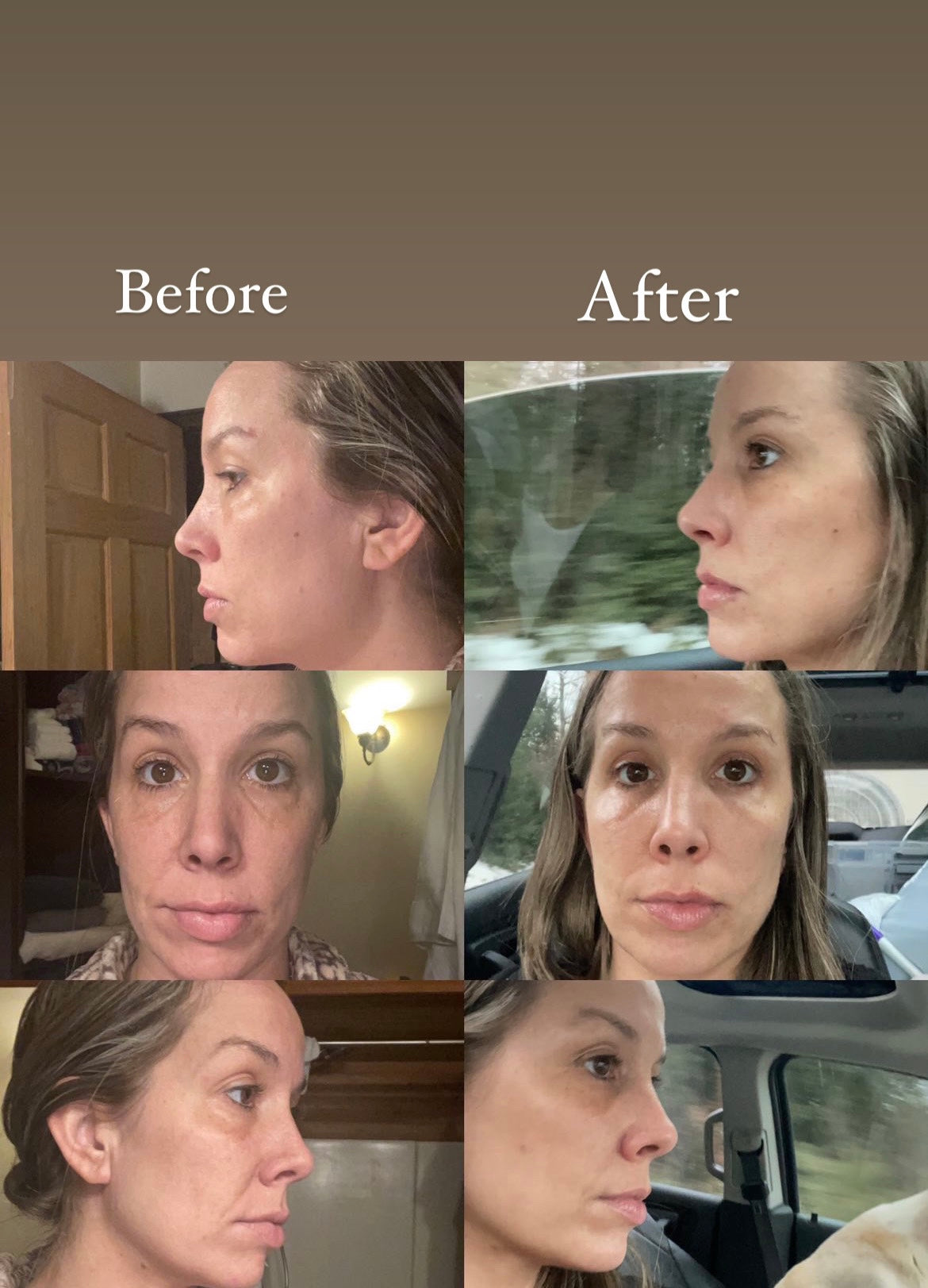 Better Than Botox Bee Venom Facial Cream