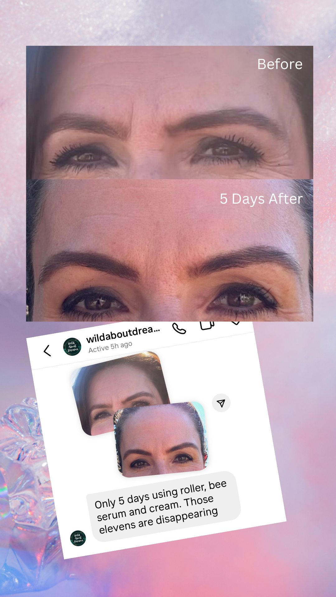Better Than Botox Collection